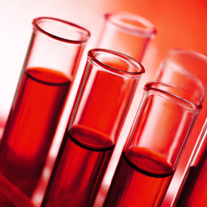 Kwasica mleczanowa: przyczyny, objawy i leczenie - groźne powikłanie metaboliczne