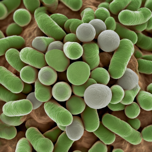 Enterococcus – charakterystyka, objawy zakażenia, diagnostyka, leczenie