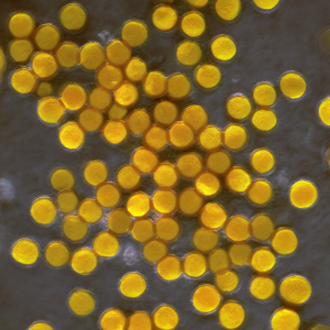 Gronkowiec skórny – przyczyny, objawy, diagnostyka, leczenie