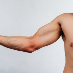 Zapalenie kaletki maziowej – przyczyny, objawy, leczenie