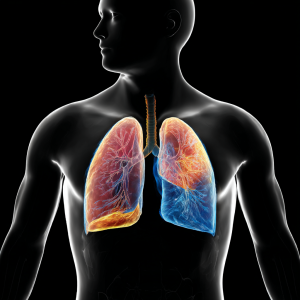 Zwłóknienie płuc – przyczyny, objawy, leczenie