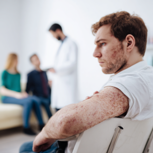 Choroby autoimmunologiczne – rodzaje, objawy, przyczyny, dziedziczność