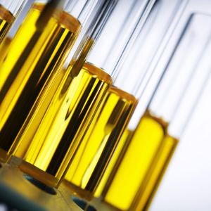 Badanie moczu – jak się przygotować? Instrukcja pobrania próbki