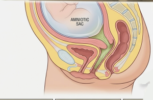 Czop śluzowy w ciąży – jak wygląda, kiedy odchodzi i co oznacza?